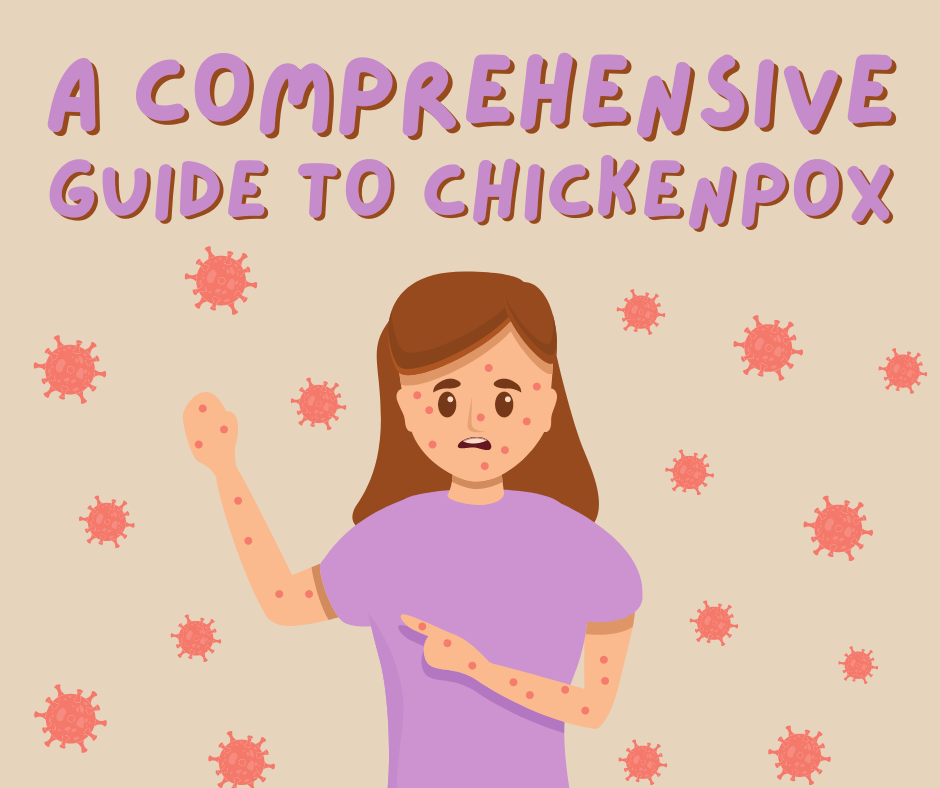 A Comprehensive Guide to Chickenpox